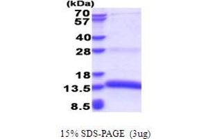 Image no. 1 for Marginal Zone B and B1 Cell-Specific Protein (MZB1) (AA 1-97) protein (His tag) (ABIN5853641)