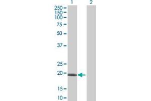 Image no. 1 for anti-Interferon, omega 1 (IFNW) (AA 1-195) antibody (ABIN516933)