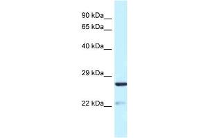 Image no. 1 for anti-Yip1 Domain Family, Member 5 (YIPF5) (N-Term) antibody (ABIN2782000)