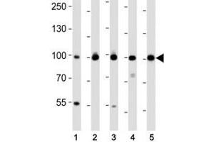 Image no. 5 for anti-Enhancer of Zeste Homolog 2 (EZH2) antibody (ABIN3028636)