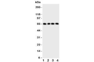 Western blot testing of PTH1R antibody and Lane 1:  SKOV