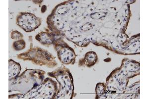 Image no. 1 for anti-ADP-Ribosylarginine Hydrolase (ADPRH) (AA 23-121) antibody (ABIN513152)