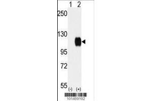 Image no. 2 for anti-TYRO3 Protein Tyrosine Kinase (TYRO3) (AA 842-873), (C-Term) antibody (ABIN392054)