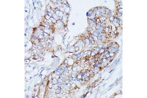 MANBA antibody  (AA 18-300)