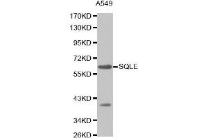Western Blotting (WB) image for anti-Squalene Epoxidase (SQLE) (AA 143-400) antibody (ABIN1513563)