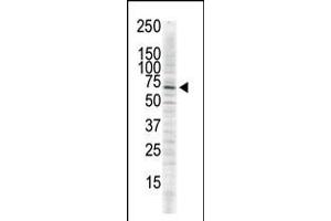 Image no. 2 for anti-Calcium/calmodulin-Dependent Protein Kinase II delta (CAMK2D) (AA 448-478), (C-Term) antibody (ABIN5533838)