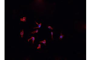 Image no. 2 for anti-Ferritin, Light Polypeptide (FTL) antibody (ABIN6261826)