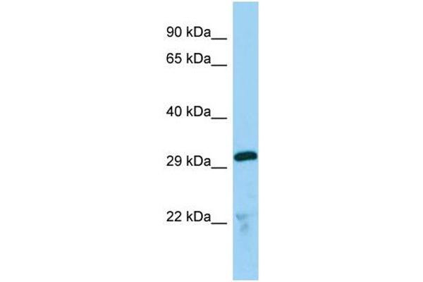 anti-Thioredoxin-Related Transmembrane Protein 2 (TMX2) (C-Term) antibody