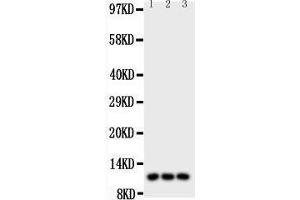 Image no. 1 for anti-Chemokine (C-C Motif) Ligand 1 (CCL1) (AA 24-96) antibody (ABIN3043738)