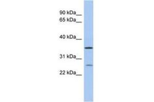 Image no. 1 for anti-Short Chain Dehydrogenase/reductase Family 9C, Member 7 (SDR9C7) (C-Term) antibody (ABIN6743679)