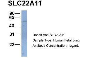 Image no. 3 for anti-Solute Carrier Family 22 (Organic Cation Transporter), Member 11 (SLC22A11) (C-Term) antibody (ABIN2781664)