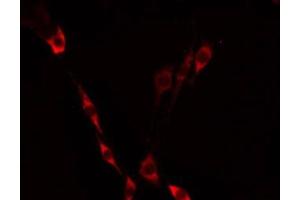 Image no. 1 for anti-Mitochondrial Ribosomal Protein S21 (MRPS21) (C-Term) antibody (ABIN6258449)