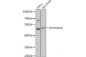 Western blot analysis of extracts of various cell lines using Aromatase Polyclonal Antibody at dilution of 1:3000.