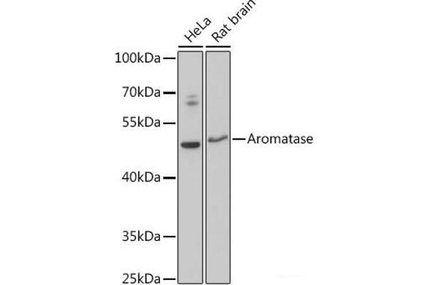 Aromatase Antikörper