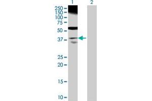 Image no. 1 for anti-Retinitis Pigmentosa 2 (X-Linked Recessive) (RP2) (AA 1-350) antibody (ABIN519839)