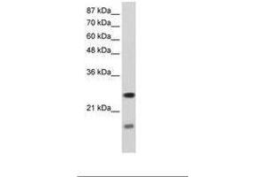 Image no. 2 for anti-Signal Recognition Particle 14kDa (Homologous Alu RNA Binding Protein) (SRP14) (AA 38-87) antibody (ABIN202027)