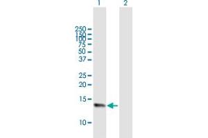 Western Blot analysis of NMS expression in transfected 293T cell line by NMS MaxPab polyclonal antibody.