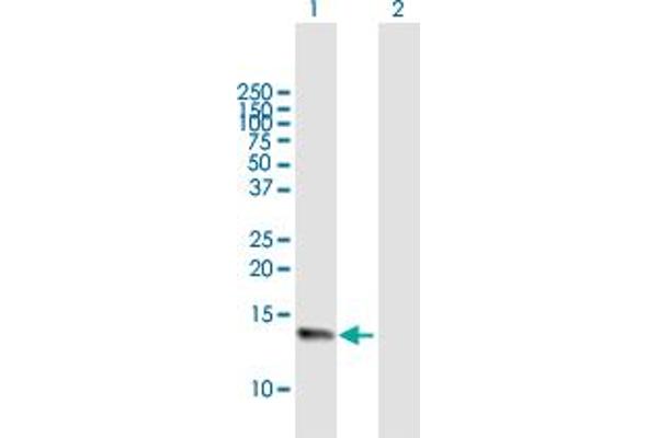 anti-Neuromedin S (NMS) (AA 1-153) antibody