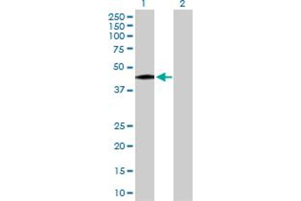 anti-Dihydrolipoamide S-Succinyltransferase (E2 Component of 2-Oxo-Glutarate Complex) (DLST) (AA 1-453) antibody