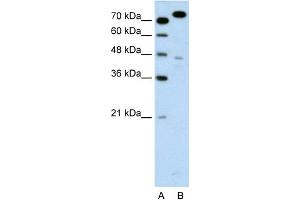 Image no. 3 for anti-Minichromosome Maintenance Complex Component 3 (MCM3) (C-Term) antibody (ABIN2774880)