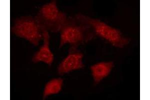 Image no. 3 for anti-Acrosin (ACR) (N-Term) antibody (ABIN6259739)