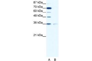 Image no. 1 for anti-Zinc Finger Protein 326 (ZNF326) (C-Term) antibody (ABIN2777480)