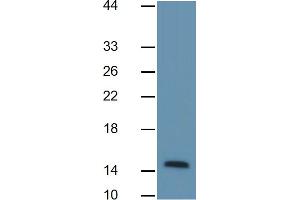 Image no. 1 for Fatty Acid Binding Protein 4, Adipocyte (FABP4) ELISA Kit (ABIN6730861)