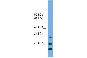 Image no. 1 for anti-ASF1 Anti-Silencing Function 1 Homolog A (S. Cerevisiae) (ASF1A) (N-Term) antibody (ABIN2787613)