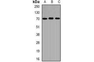 Image no. 1 for anti-Aminolevulinate, delta-, Synthase 1 (ALAS1) antibody (ABIN2966401)