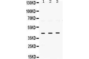 Image no. 2 for anti-ELAV (Embryonic Lethal, Abnormal Vision, Drosophila)-Like 4 (Hu Antigen D) (ELAVL4) (AA 8-45), (N-Term) antibody (ABIN3043372)