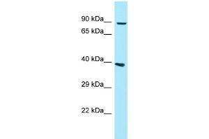 Image no. 1 for anti-Glycosylphosphatidylinositol Specific phospholipase D1 (GPLD1) (N-Term) antibody (ABIN2790409)