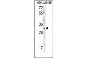 Image no. 1 for anti-DTW Domain Containing 1 (DTWD1) (AA 151-181), (Middle Region) antibody (ABIN951990)