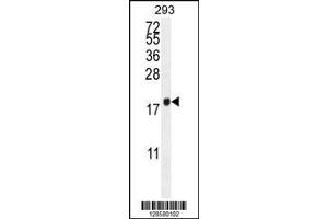 Image no. 3 for anti-C1QTNF9B Antisense RNA 1 (C1QTNF9B-AS1) (AA 14-42) antibody (ABIN654598)