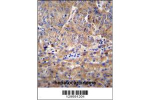 Immunohistochemistry (IHC) image for anti-Transcription Elongation Factor A (SII) N-Terminal and Central Domain Containing 2 (TCEANC2) (N-Term) antibody (ABIN2160550)