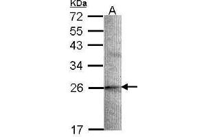 Image no. 1 for anti-Stathmin-Like 2 (STMN2) (N-Term) antibody (ABIN2856371)