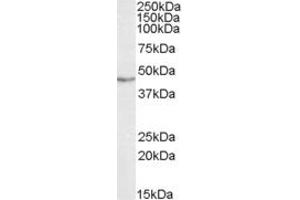 Image no. 2 for anti-TAR DNA Binding Protein (TARDBP) (Internal Region) antibody (ABIN334503)