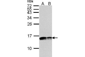 WB Image Sample(30 ug whole cell lysate) A:HeLa S3, B:Hep G2 , 15% SDS PAGE antibody diluted at 1:5000