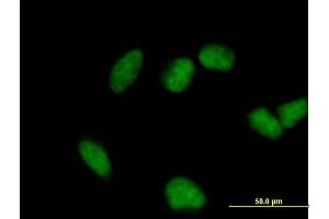 Image no. 1 for anti-Four and A Half LIM Domains 3 (FHL3) (AA 1-280) antibody (ABIN2565532)