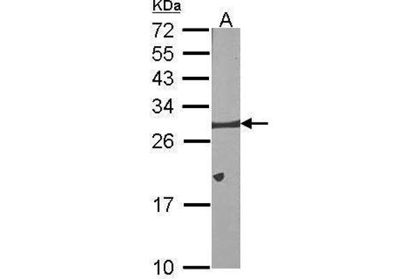 BCL2L1 Antikörper  (Center)