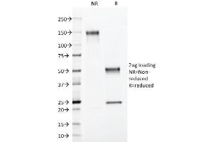 Image no. 5 for anti-S100 Calcium Binding Protein B (S100B) antibody (ABIN6940555)