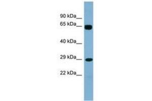 LRRN4CL anticorps  (AA 107-156)