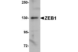 Western Blotting (WB) image for anti-Zinc Finger E-Box Binding Homeobox 1 (ZEB1) (Middle Region) antibody (ABIN1031173)