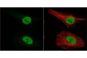 Image no. 4 for anti-Musashi Homolog 1 (Drosophila) (MSI1) (Center) antibody (ABIN2855085)