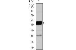 Image no. 3 for anti-CCAAT/enhancer Binding Protein (C/EBP), alpha (CEBPA) antibody (ABIN969507)