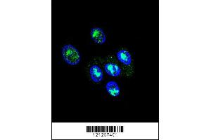 Image no. 2 for anti-Forkhead Box P2 (FOXP2) (AA 657-684) antibody (ABIN651939)