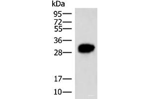 HCCS antibody