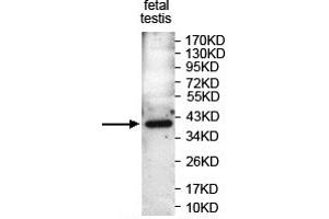 Image no. 1 for anti-PCNA Clamp Associated Factor (PAF) (AA 8-101) antibody (ABIN1855275)
