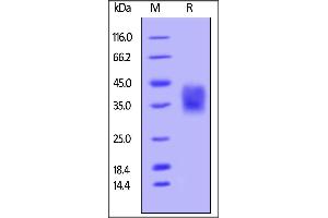 Image no. 1 for CD47 (CD47) (AA 19-139) (Active) protein (His tag,AVI tag) (ABIN4949217)