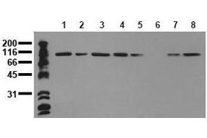 Image no. 1 for anti-Catenin (Cadherin-Associated Protein), alpha 1, 102kDa (CTNNA1) antibody (ABIN126738)