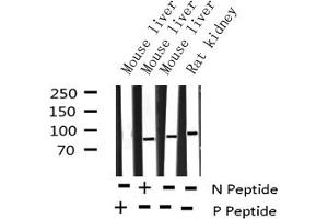 Image no. 3 for anti-conserved Helix-Loop-Helix Ubiquitous Kinase (CHUK) (pThr23) antibody (ABIN6255637)